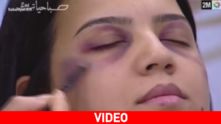 Μαρόκο: Εκπομπή στην κρατική τηλεόραση δίνει… tips για μακιγιάζ μετά τον ξυλοδαρμό