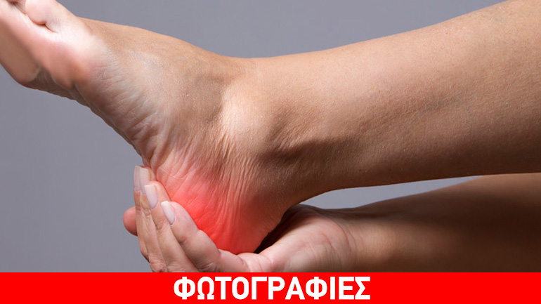 Smart  Insole για τον πόνο στο πέλμα