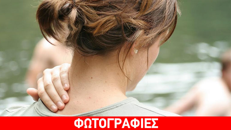 Πόνος στον Αυχένα: Αίτια, συμπτώματα, και τρόποι θεραπείας