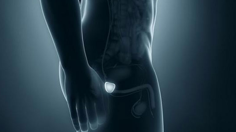 Η ρομποτική στο πλευρό της διάγνωσης του καρκίνου στον προστάτη