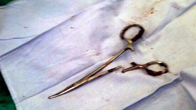 Χειρουργική λαβίδα αφαιρέθηκε από την κοιλιά ενός Βιετναμέζου έπειτα από 18 χρόνια