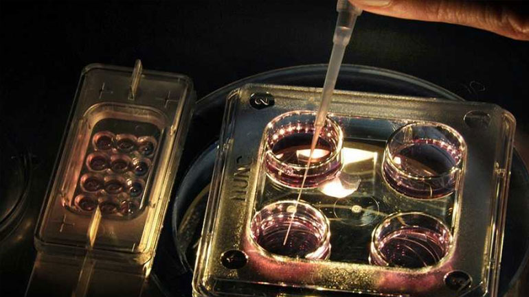 Επιτυχής η πρώτη δοκιμή σε ανθρώπους νέου εμβολίου για την ελονοσία