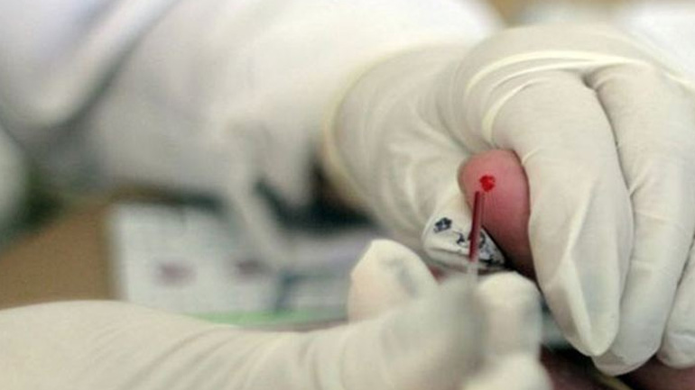 Σχεδόν οι μισοί οροθετικοί σε όλον τον κόσμο δεν γνωρίζουν ότι είναι φορείς του HIV