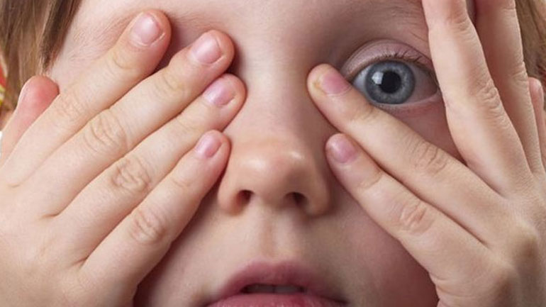 Επιπεφυκίτιδα στα παιδιά: Όλα όσα πρέπει να γνωρίζετε