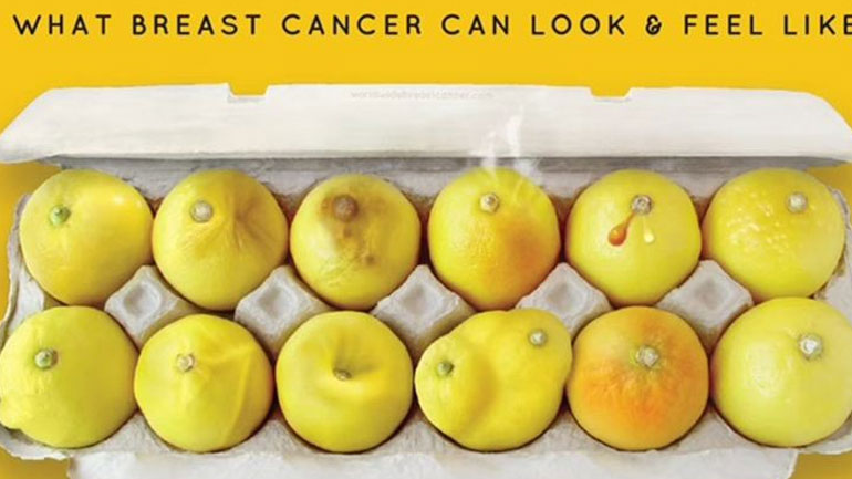 Η φωτογραφία με τα λεμόνια που έγινε viral και μπορεί να σώσει χιλιάδες ζωές γυναικών