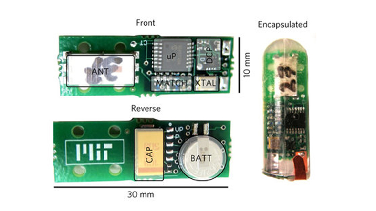 Το στομάχι σε ρόλο μπαταρίας: Συσκευή καταπίνεται και τροφοδοτείται με ενέργεια από το γαστρικό οξύ