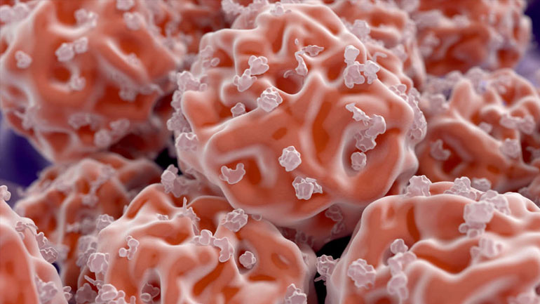 Γαλλία: Πρώτη φορά θεραπεύθηκε έφηβος με δρεπανοκυτταρική αναιμία