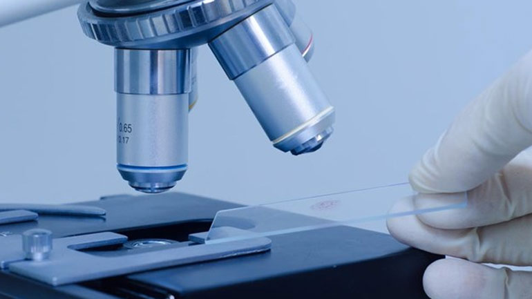 Ανακαλύφθηκε εξέταση που προβλέπει έγκαιρα ποιος ασθενής κινδυνεύει να πεθάνει από σήψη