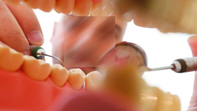 Οδοντοτεχνίτης… ξεδόντιαζε χωρίς άδεια