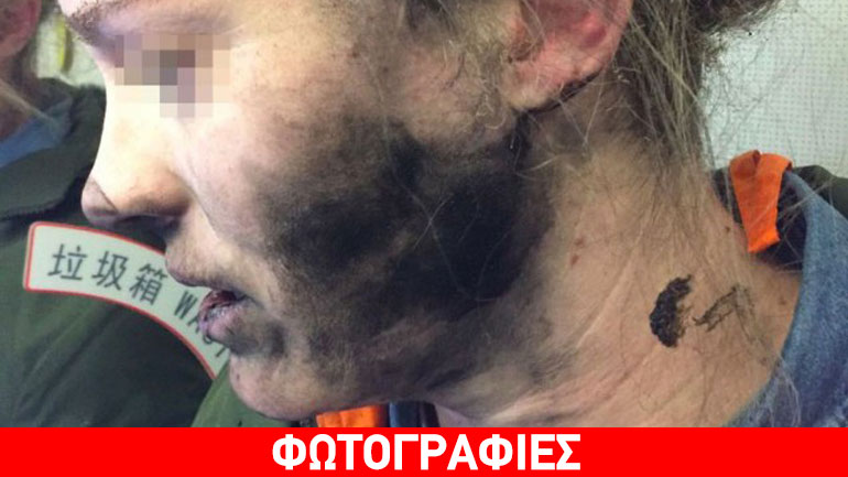 Επιβάτης τραυματίστηκε από ακουστικά που εξερράγησαν εν πτήσει