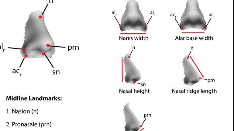 H εξελεγκτική πορεία της… μύτης
