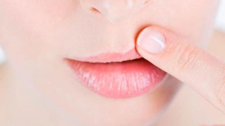 Πώς να αντιμετωπίσετε τον έρπη στα χείλη;