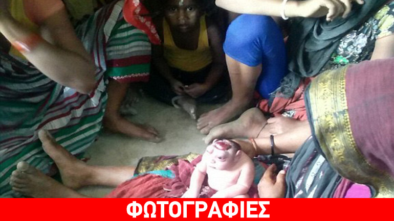 Ινδή μητέρα έπαθε σοκ όταν αντίκρισε το νεογέννητο μωρό της – Πίστεψε πως ήταν εξωγήινος