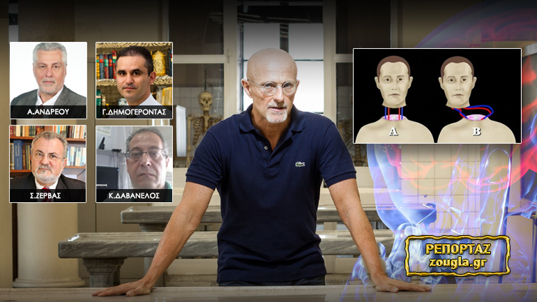 Σχεδιάζουν μεταμόσχευση ανθρώπινης κεφαλής