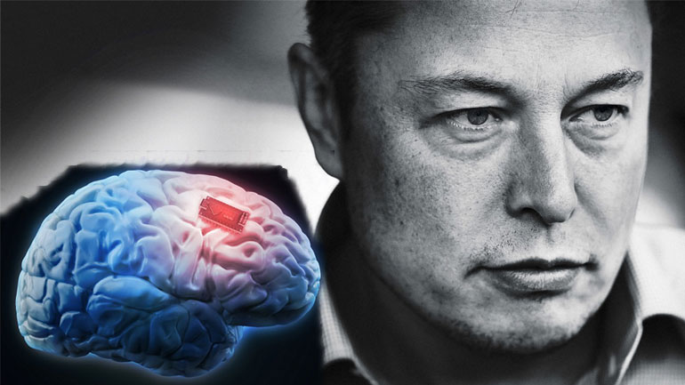 Ο Elon Musk προσπαθεί να συνδέσει το ανθρώπινο μυαλό με μηχανές  μέσω εμφυτευμάτων