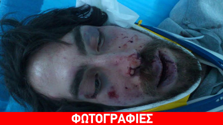 Χρυσαυγίτες ξυλοκόπησαν φοιτητή ως αντίποινα για την επίθεση στα γραφεία