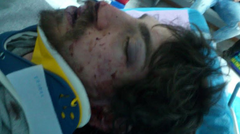 Ποινική δίωξη για τον άγριο ξυλοδαρμό φοιτητή στους Αμπελόκηπους