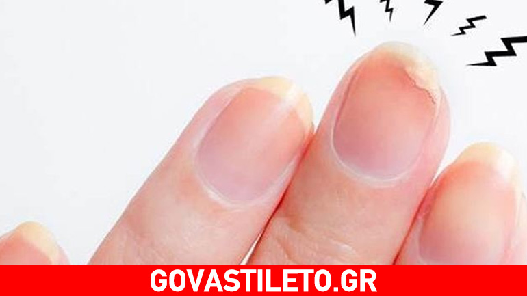 Η beauty editor του govastileto.gr σου δείχνει πώς να διορθώσεις γρήγορα ένα σπασμένο νύχι για να μη χάσεις το ραντεβού σου