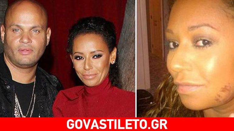 Σοκάρει η Mel B : «Ο σύζυγός μου με κακοποιούσε, με ανάγκαζε σε τρίο και άφησε έγκυο τη νταντά»