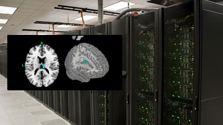 Ο υπερυπολογιστής Stampede κάνει διαγνώσεις της κατάθλιψης μελετώντας τις εικόνες του εγκεφάλου