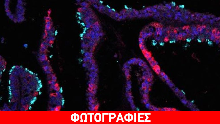 Βρετανία: Επιστήμονες δημιούργησαν στο εργαστήριο «μίνι» ενδομήτριο