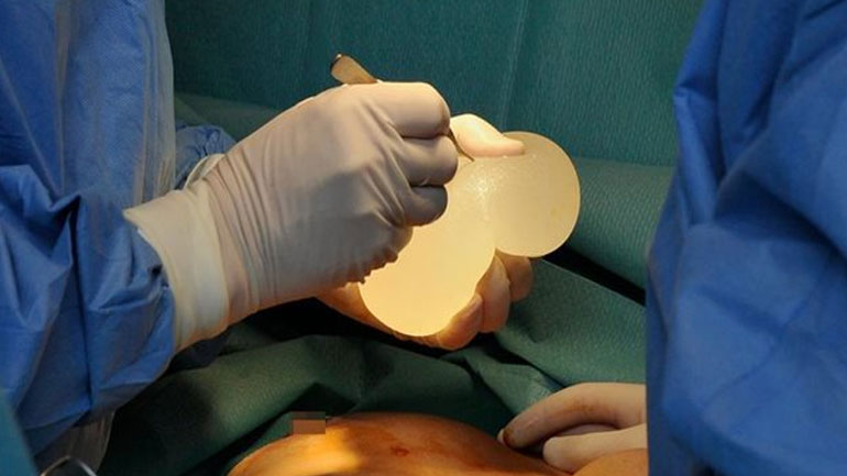 Πιο αυστηροί έλεγχοι μετά τα ελαττωματικά εμφυτεύματα σιλικόνης