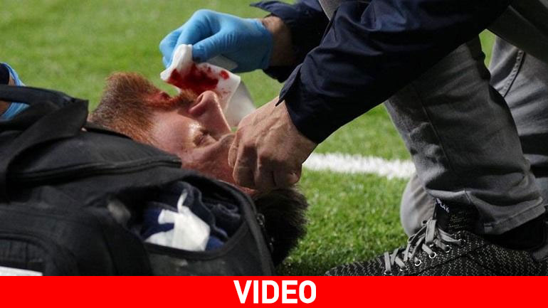 Έχασε δόντι ο Μέσι από την αγκωνιά του Μαρσέλο