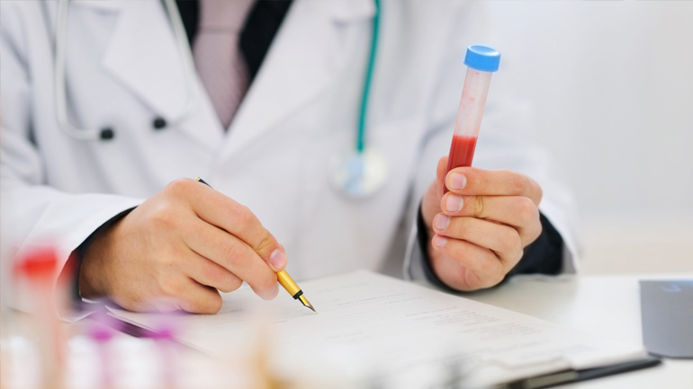 Νέο τεστ αίματος προβλέπει την επανεμφάνιση του καρκίνου των πνευμόνων