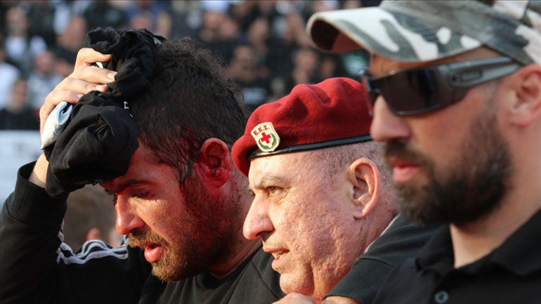 Αιμόφυρτος οπαδός του ΠΑΟΚ που δέχτηκε αντικείμενο στο κεφάλι