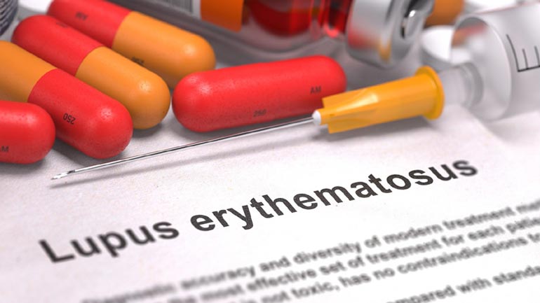 Περισσότεροι από 500.000 άνθρωποι νοσούν στην Ευρώπη από Συστηματικό Ερυθηματώδη Λύκο