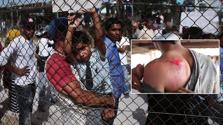 Βίντεο ντροπή από καταυλισμό στην Πάτρα