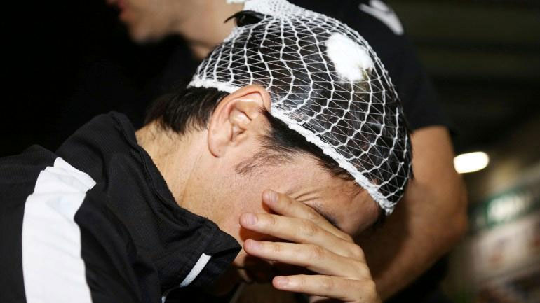 «Επιφανειακή εκδορά» η γνωμάτευση του γιατρού για τον τραυματισμό του Ίβιτς