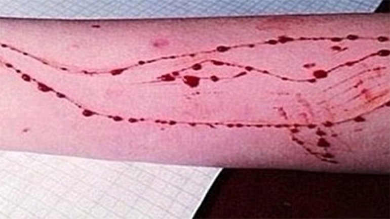 Σήμα κινδύνου και από τον Άρειο Πάγο για το φαινόμενο της «Μπλε Φάλαινας»