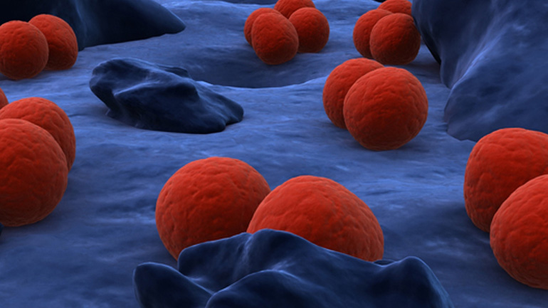 Πώς το βακτήριο της γονόρροιας επηρεάζει το αναπαραγωγικό σύστημα της γυναίκας;