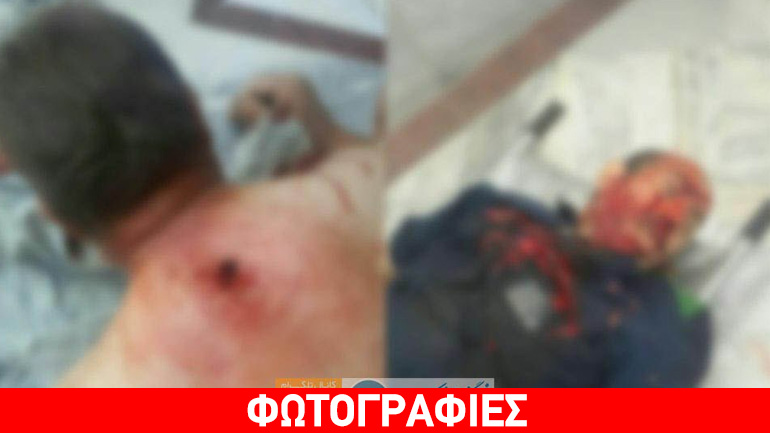 Καρέ-καρέ οι αιματηρές επιθέσεις στο Ιράν