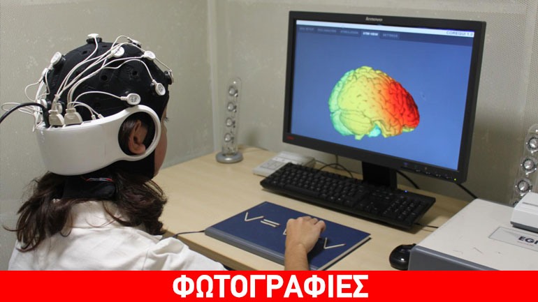Ηλεκτρικό «καπέλο» διεγείρει τον εγκέφαλο και βελτιώνει τη δημιουργικότητα των ανθρώπων