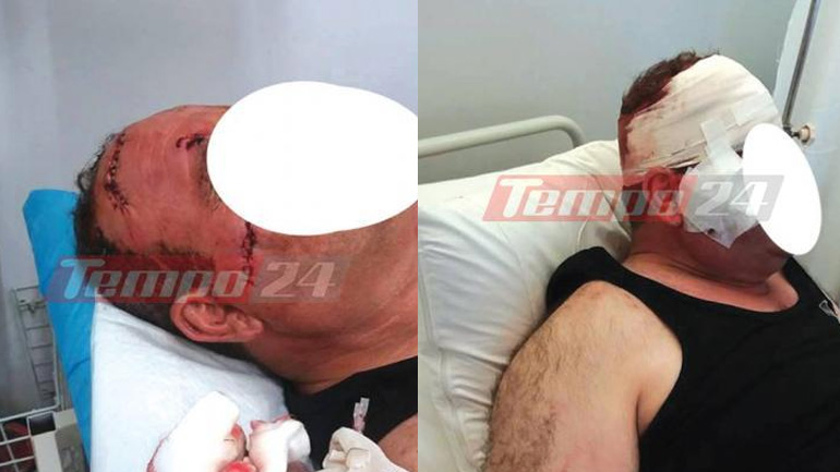 Ασθενής ζήτησε το λόγο από γιατρό και εκείνος τον χαράκωσε στο πρόσωπο