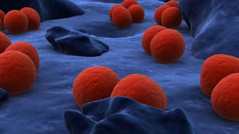 Γιατί είναι πολύ σημαντική η πρόληψη της γονόρροιας;