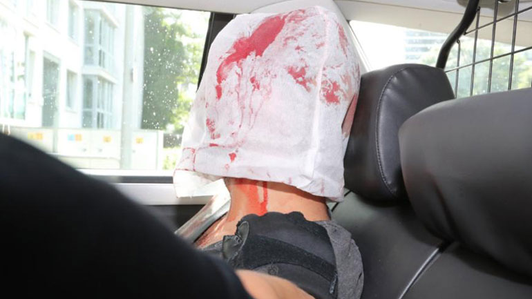 Φωτογραφία-ντοκουμέντο του δράστη της επίθεσης στο Αμβούργο