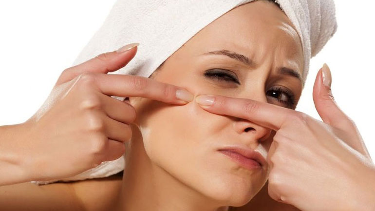 Η Τέτα Καμπουρέλη μάς δείχνει πώς να καταπολεμήσουμε την ακμή!