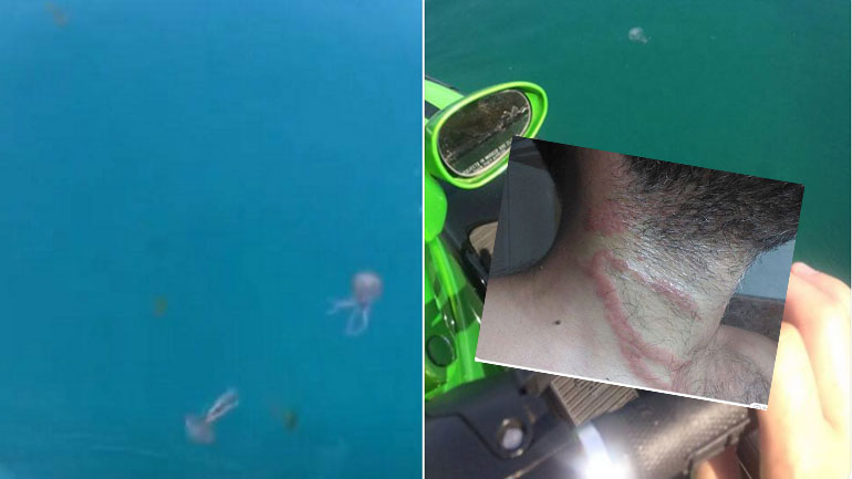 Οι αναγνώστες του zougla.gr στέλνουν ενημέρωση για τις τσούχτρες