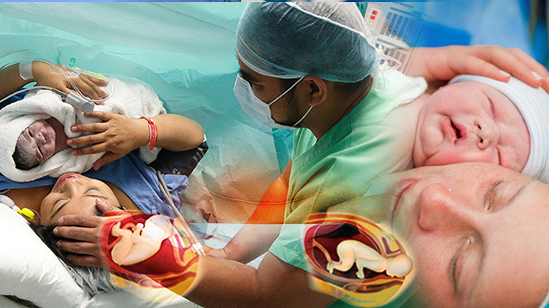 Έκρηξη γεννήσεων με καισαρική στην Ελλάδα