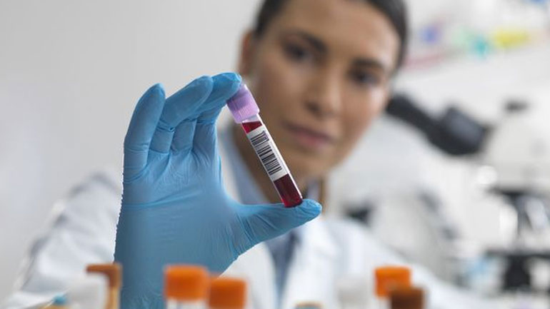 ΗΠΑ: Νέα εξέταση αίματος δίνει ελπίδες για τη έγκαιρη διάγνωση καρκίνου