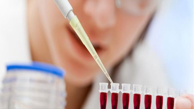 Νέο τεστ αίματος για την ταχεία διάγνωση του καρκίνου Νέο τεστ αίματος για την ταχεία διάγνωση του καρκίνου