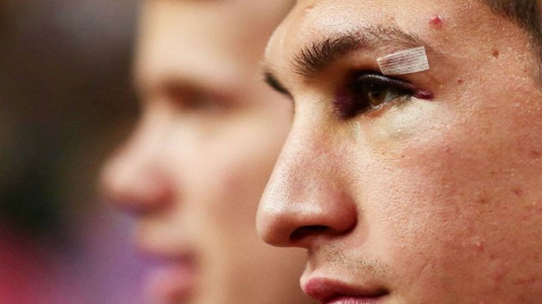 Το χτύπημα στο πρόσωπο του Λαρεντζάκη