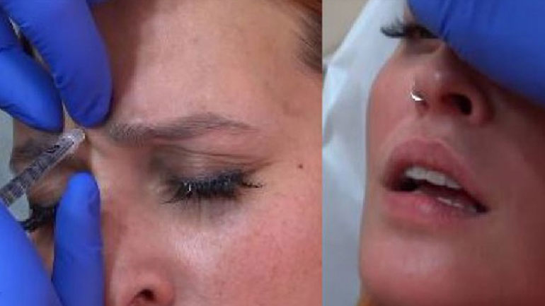 Η Σίσσυ Χρηστίδου κάνει μπότοξ on camera!