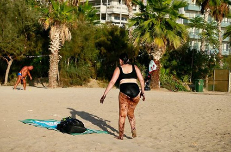 Πρόσφατη φωτογραφία Γάλλου φωτορεπόρτερ από την παραλία του Φαλήρου, όπου μια γυναίκα αποφάσισε να μην στερηθεί του μπάνιου της... Το αποτέλεσμα στο σώμα της τα λέει όλα. 