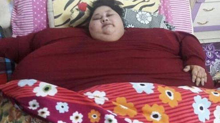 Έφυγε από τη ζωή η γυναίκα που ζύγιζε 499 κιλά