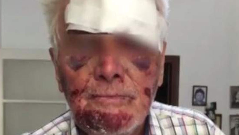 Ληστές μαχαίρωσαν και χτύπησαν 90χρονο για 5 ευρώ στο Γαλάτσι