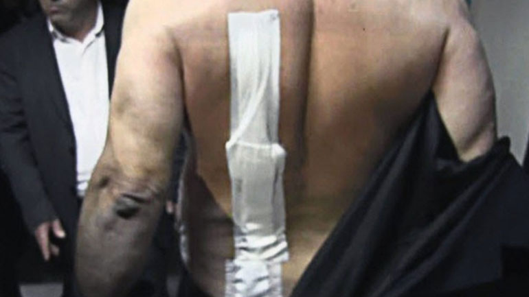 Ποινή 10 μηνών με αναστολή σε 55χρονη για πρόκληση επικίνδυνης σωματικής βλάβης σε δηµοτικό σύµβουλο